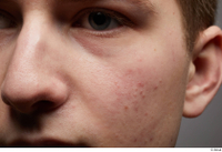  HD Face Skin Casey Schneider cheek face skin pores skin texture 0001.jpg